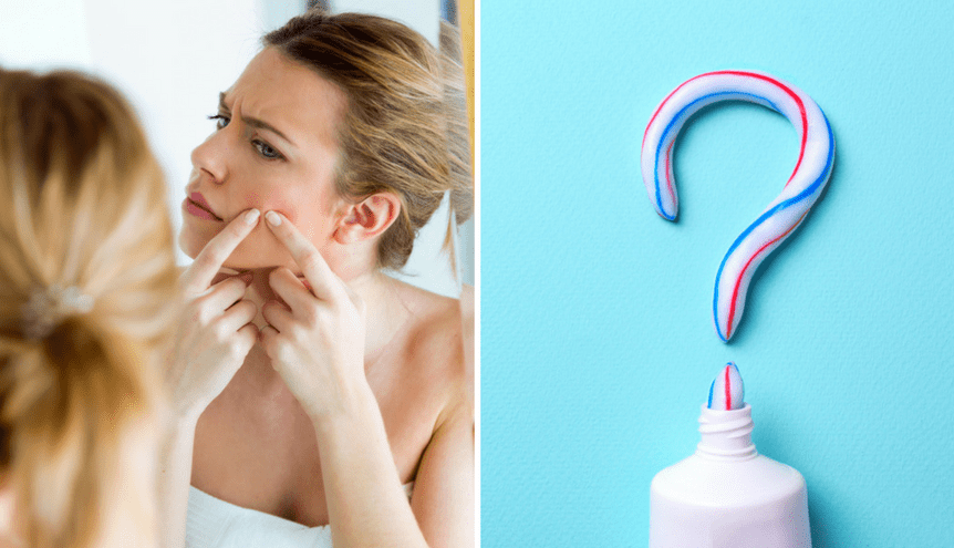 Czy pasta do zębów naprawdę pomaga pozbyć się pryszczy?