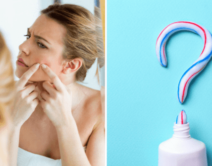Czy pasta do zębów naprawdę pomaga pozbyć się pryszczy?