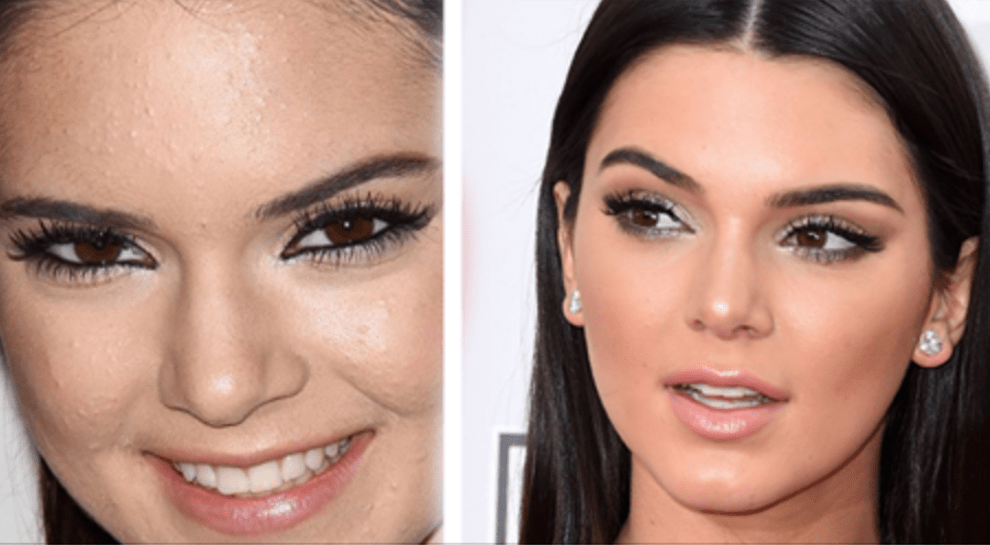 To przez TE produkty nie możesz pozbyć się trądziku.