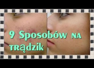 9 sposobów na pozbycie się trądziku  ♥