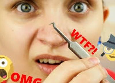 Profesjonalne wyciskanie pryszczy i wągrów w domu?!