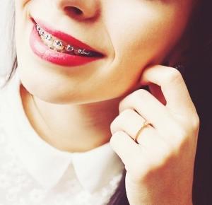 pożegnanie z aparatem!