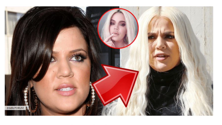 CO SIĘ STAŁO Z TWARZĄ KHLOE KARDASHIAN? NIEUDANA OPERACJA?