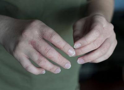 Dłonie w niewidzialnych rękawiczkach.