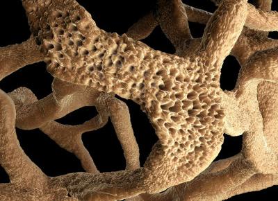 Jak zadbać o zdrowe kości?