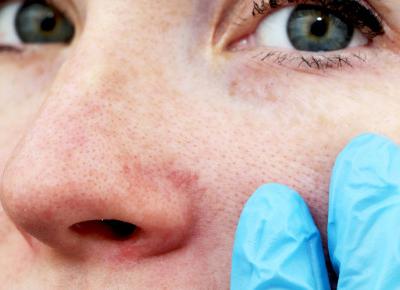 Jeśli twoja cera się przetłuszcza.