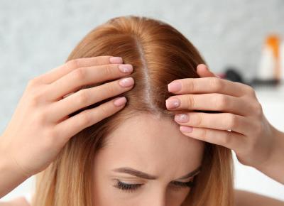​Dlaczego wypadają mi włosy?