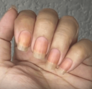 Jak wybielić paznokcie domowym sposobem? Prosty sposób