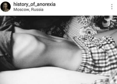 History of Anorexia. Walcząca ze sobą.