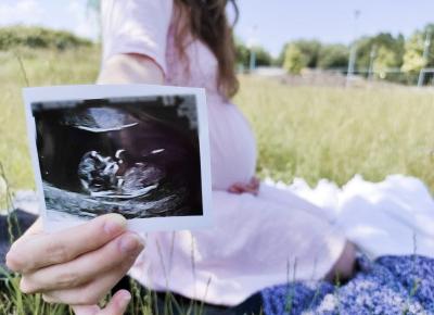 Koci punkt widzenia: Ile kosztuje prowadzenie ciąży prywatnie?