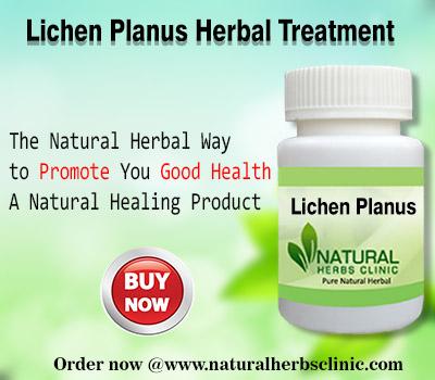 Herbal Remedy for Lichen Planus Herbal Treatment