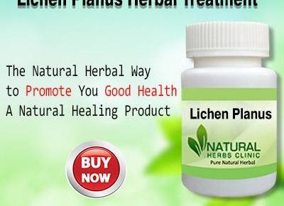 Herbal Remedy for Lichen Planus Herbal Treatment