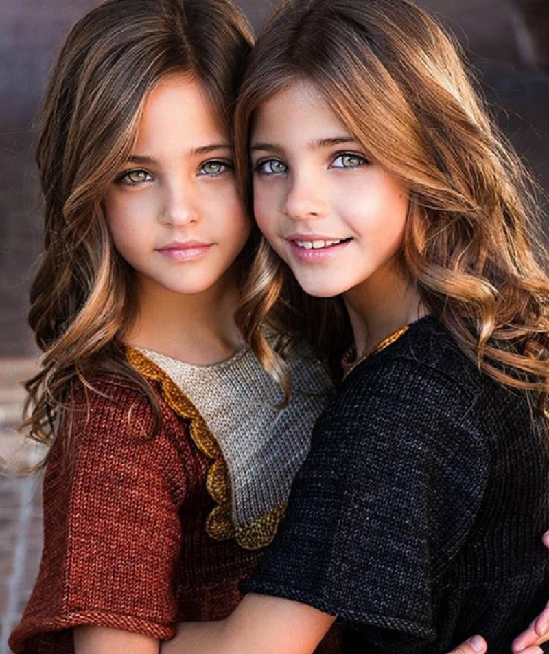 Najpiękniejsze bliźniaczki w historii. Jak dziś wyglądają?
