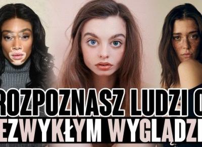 Czy dasz radę rozpoznać ludzi o niezwykłym wyglądzie?