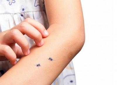 Ukąszenia komarów - domowe sposoby
