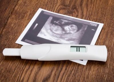 Badania prenatalne – co facet powinien wiedzieć? | Tatą Być - Blog młodego ojca | Wychowanie dziecka okiem faceta