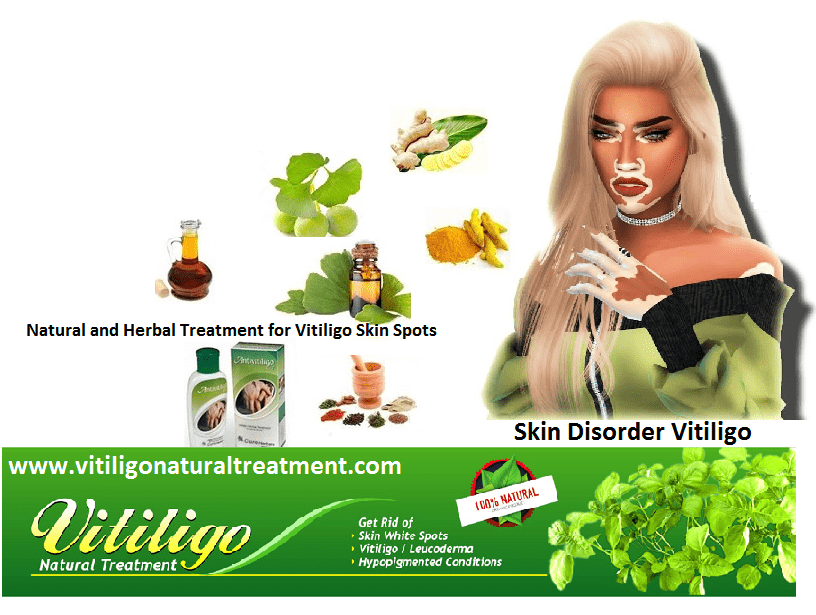 Natural and Herbal Treatment for Vitiligo Skin Spots