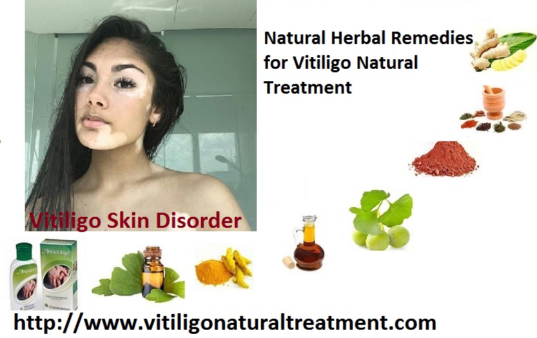 Vitiligo Natural