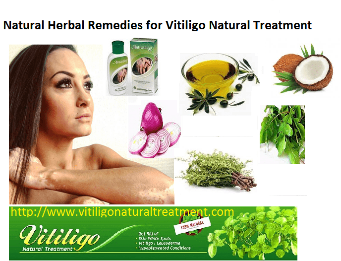 Here We Describes the Vitiligo Skin Disorder and its Treatment with Natural Herbal Ways