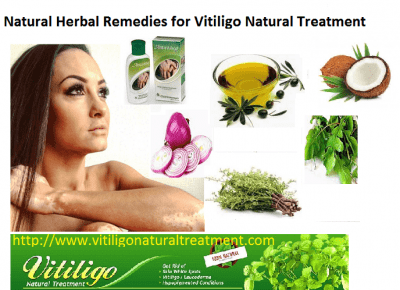 Here We Describes the Vitiligo Skin Disorder and its Treatment with Natural Herbal Ways